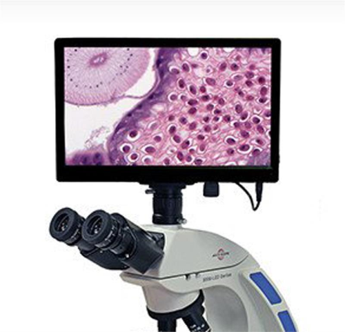 Excelis HD Camera plus HD Retina Screen, Accu-Scope, AU-600-HDS